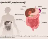 Ilustracja przedstawia narządy jamy brzusznej: wątrobę, żołądek, nerki, trzustkę, jelita, pęcherzyk żółciowy i śledzionę. USG jamy brzusznej pomaga wykryć choroby.