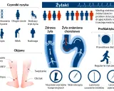 Jak dbać o żyły? Infografika przedstawia czynniki ryzyka żylaków, objawy, zdrową i chorą żyłę, a także profilaktykę: dietę, ćwiczenia, wyroby kompresyjne i metody leczenia.