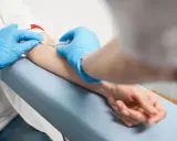 Pobieranie krwi do badań, które pomogą ocenić, co produkuje progesteron.