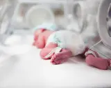 Un bebé prematuro duerme en una incubadora de bebés, con pulseras de identificación en sus tobillos.