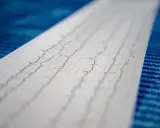 Wynik badania EKG, zapis fal na papierze milimetrowym.