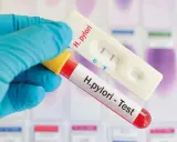 Rękawiczka trzyma probówkę z krwią i test kasetkowy. Dwa paski na teście wskazują, że test ureazowy dodatni.