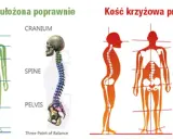 Prawidłowe i przechylone ułożenie kości krzyżowej kręgosłupa. Porównanie postawy ciała.