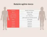 Tabela z badaniem ogólnym moczu: parametry, wartości referencyjne. Uryna co to? To płyn wydalany przez nerki, a jego analiza ujawnia wiele o zdrowiu.