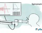 Spirometrie-Diagramm zeigt Lungenfunktion. Wichtig für COPD Gold 3 Rente.