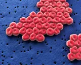 Acinetobacter baumannii, batterio resistente, si guarisce. Globuli rossi rossi su sfondo blu con piccoli fori.