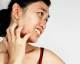 Une femme se gratte le cou et le visage, visiblement gênée par une peau très sèche et des démangeaisons.