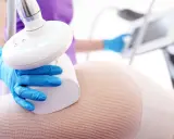 Endermologia: Jakie odstępy? Planuj mądrze dla trwałych efektów.