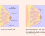 Brust im 2. Trimester: Hormone erweitern Milchgänge, was zu Brustschmerzen führen kann. Die Durchblutung des Brustgewebes nimmt zu.