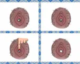 Illustration visar hur en menskopp vecklar ut sig. En hand trycker på den för att hjälpa den att veckla ut sig.