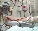 Ramię pacjenta podłączone do aparatury do dializy. Częstotliwość dializ jest kluczowa dla jego zdrowia.