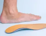 Un pied humain et une semelle orthopédique, conçue pour soulager les douleurs liées aux durillons et aux problèmes de voûte plantaire.