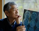 Uomo anziano con scansione cerebrale, riflette sulla possibilità che l'alzheimer sia ereditario.