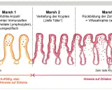 Darstellung der Marsh-Klassifikation von Zöliakie: Von gesunder Schleimhaut (Marsh 0) über Entzündung (Marsh 1-2) bis zur Zottenatrophie (Marsh 3), die bei einer **Haferallergie** auftreten kann.