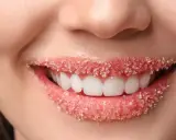 Usta pokryte cukrowym peelingiem, idealne po zabiegu powiększania ust.