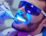 Wybielanie zębów u dentysty: czy warto? Analiza kosztów i efektów