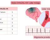 Tabela CHA2DS2-VA, schemat mózgu z udarem, naczynie krwionośne z zakrzepem i EKG.