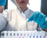 Ricerca per la terapia monoclonale: una mano guantata usa un contagocce per trasferire un liquido viola in una provetta, parte di un esperimento in laboratorio.