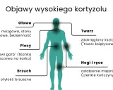Wysoki kortyzol objawy: mgła mózgowa, stany lękowe, bezsenność, "wdowi garb", otyłość brzuszna, zaokrąglona twarz, osłabienie mięśni.