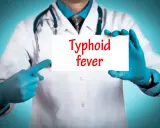 Läkare med blå handskar pekar på en skylt med texten "Typhoid fever".