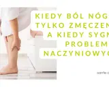 Kobieta trzyma się za łydkę, odczuwając ciągnący ból w prawej nodze. Czy to zmęczenie, czy sygnał problemów naczyniowych?