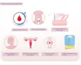 Ilustración muestra posibles causas de la regla cada 15 días: ciclos cortos, alteraciones hormonales, anticonceptivos, estrés, infecciones, embarazo o cambios de peso.