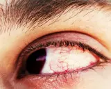 Syndrom widzenia komputerowego: objawy i jak zadbać o wzrok?