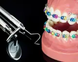 Model szczęki z kolorowym aparatem ortodontycznym i narzędziami dentystycznymi. Idealne do ćwiczeń na tyłozgryz.