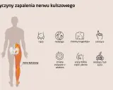 Ból i opuchlizna po przewianiu? To może być zapalenie nerwu!
