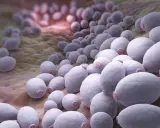 Zbliżenie na komórki grzyba Candida, które mogą powodować infekcje. Widoczne są owalne, fioletowe struktury na brązowym tle.