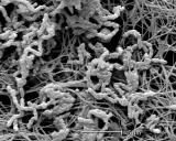 Achromobacter xylosoxidans, batteri filamentosi che colonizzano una matrice extracellulare fibrosa.