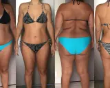 Avant/après : une femme en bikini montre sa silhouette, avec une perte de hanches visible.