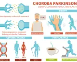 Ilustracja o chorobie Parkinsona: objawy (drżenie, spowolniony ruch, zmieniona mowa), czynniki ryzyka (genetyka, płeć, wiek) i profilaktyka (kawa, ćwiczenia).