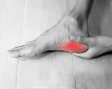 Pie con dolor en el talón, simulando fascitis plantar en niños.