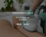 Endermologia: Hit czy Kit? Pełna analiza przed Twoją decyzją