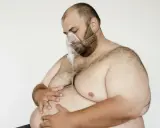 Mann mit Sauerstoffmaske, dessen stark übergewichtiger Körper auf eine ausatmung erschwert hindeutet.