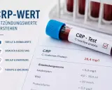 Blutprobe für CRP-Test mit Laborbericht. Der CRP-Wert von 28,4 mg/l deutet auf eine Entzündung hin.