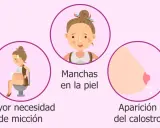 Ilustración de síntomas de embarazo: estrías, mayor necesidad de micción, manchas en la piel, aparición del calostro y problemas de espalda.