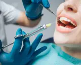 Dentysta podaje znieczulenie. Czy znieczulenie u dentysty jest szkodliwe? To pytanie nurtuje wielu pacjentów.