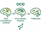 Ilustracja wyjaśnia, ocd co to jest: zmiany w korze oczodołowo-czołowej, korze zakrętu obręczy i jądrach podstawy mózgu.