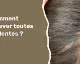 Gros plan sur des cheveux sombres infestés de lentes. Le texte "Comment enlever toutes les lentes ?" apparaît à gauche, avec des illustrations de poux en bas.