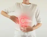 Ból brzucha i zaczerwienienie w okolicy trzustki, sugerujące zapalenie trzustki.