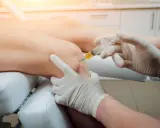 Lekarz podaje zastrzyk z osocza bogatopłytkowego do kolana pacjenta. Czy blokady są szkodliwe? To pytanie nurtuje wielu.