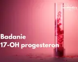 Badanie 17-OH progesteron. Podwyższony poziom może wiązać się z objawami takimi jak trądzik czy nadmierne owłosienie.