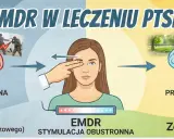 EMDR co to? Wizualizacja leczenia PTSD: od traumatycznej pamięci do przetworzonej, dzięki stymulacji obustronnej.
