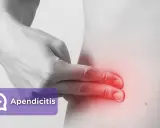 Apendicitis: ¿Dolor común o urgencia? Identifica los síntomas clave.
