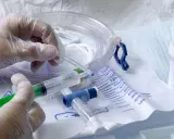 Rękawiczki medyczne, strzykawka z żelem, cewnik i worek na mocz – wszystko gotowe, by ulżyć w cierpieniu, kiedy mija ból po cewnikowaniu.