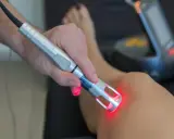 Fizjoterapeuta wykonuje laser zabieg rehabilitacyjny na kolanie pacjenta.