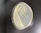 Colonia di batteri su piastra di Petri, forse Pseudomonas putida, con crescita a strisce e colonie isolate.
