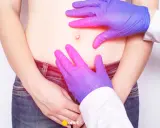 Lekarz bada brzuch, by wykluczyć przepuklinę pachwinową u dzieci. Dłonie w rękawiczkach delikatnie dotykają okolic pachwin.